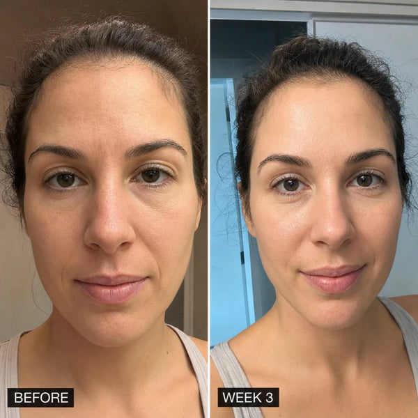 rachel, 32