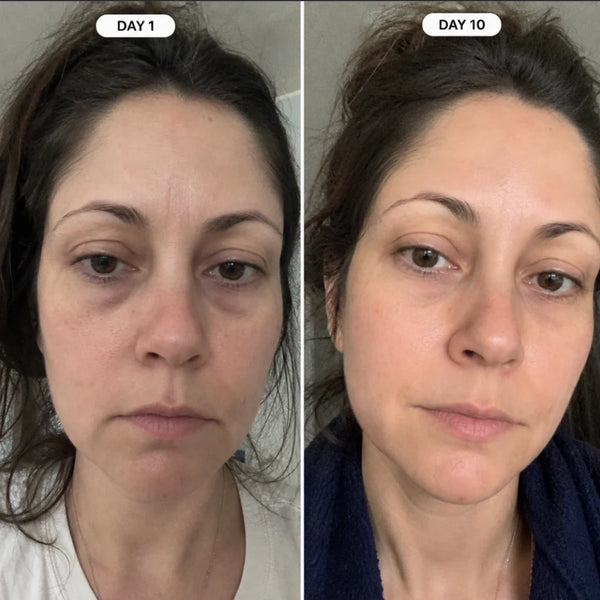 lauren, 36