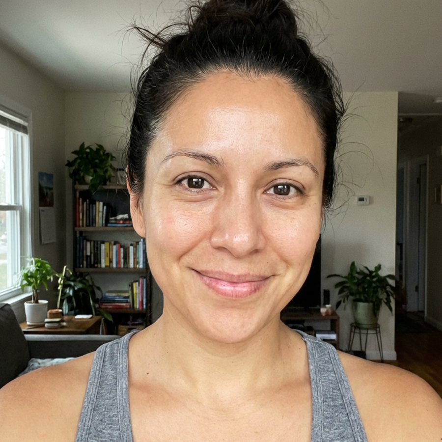 saw smoker lines, forehead creases, and tired skin look plump again with better texture