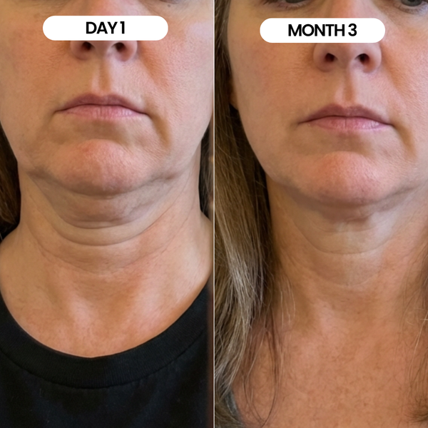 kate, 48